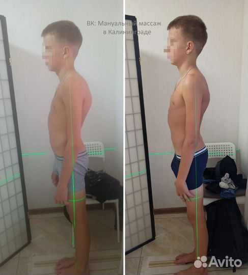 Массаж от боли в спине и стресса