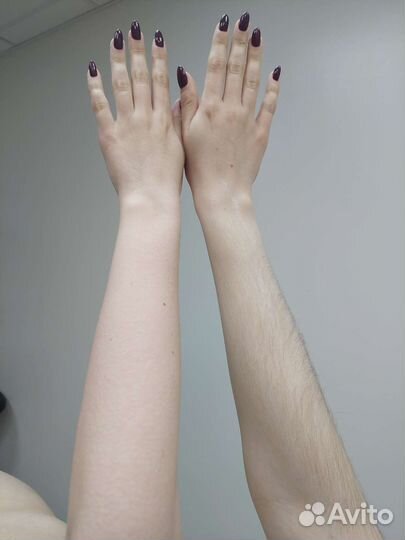 Шугаринг: руки полностью