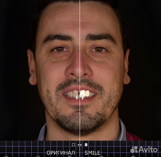 Моделировщик ExoCad, PartialCad, Exoplan, 3Diagnos