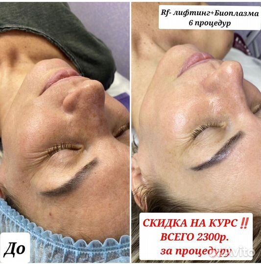 Массаж-коррекция фигуры