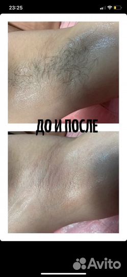 Шугаринг Депиляция женская мужская