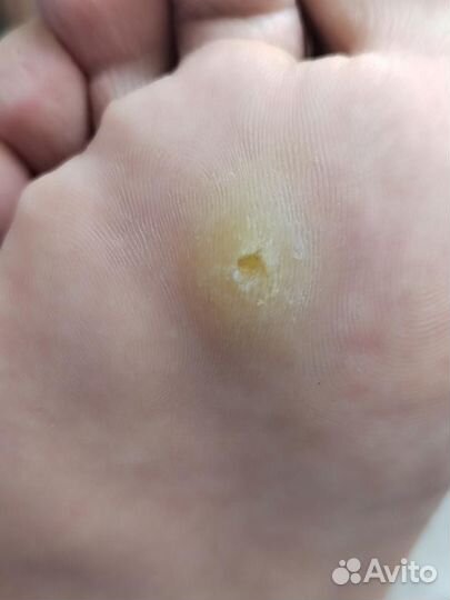 Модель на изготовление стелек