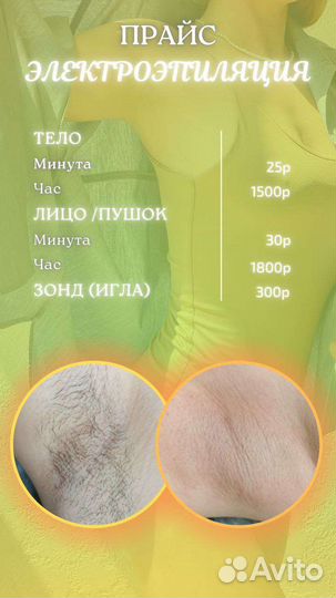Электроэпиляция шугаринг ваксинг