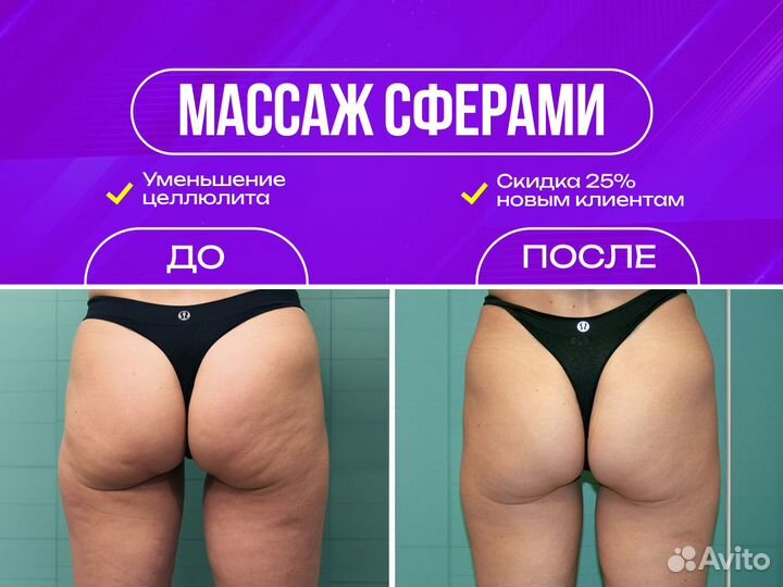 Корекция фигуры, аппаратный массаж