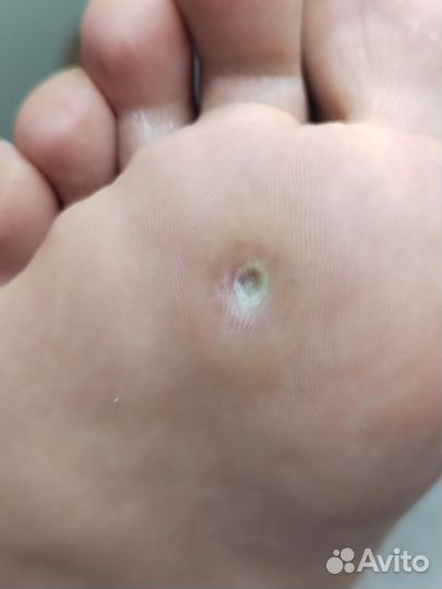 Модель на изготовление стелек