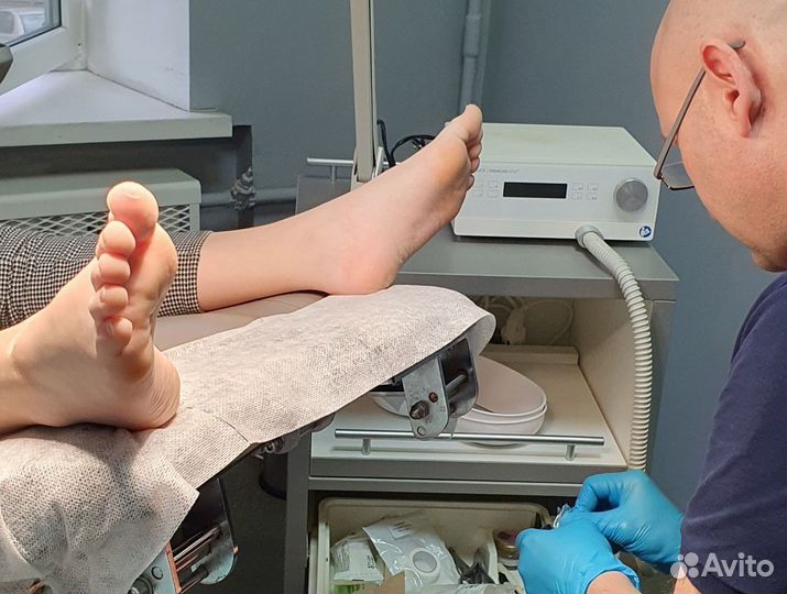 Подолог. Аппаратный педикюр, Вросший ноготь,грибок