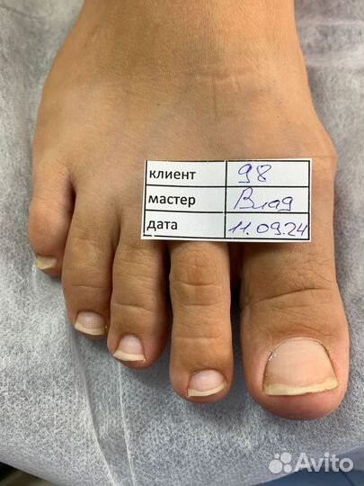 Подологический педикюр