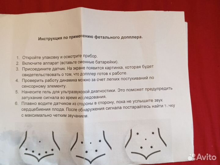 Фетальный доплер