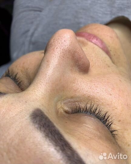 Механическая чистка лица