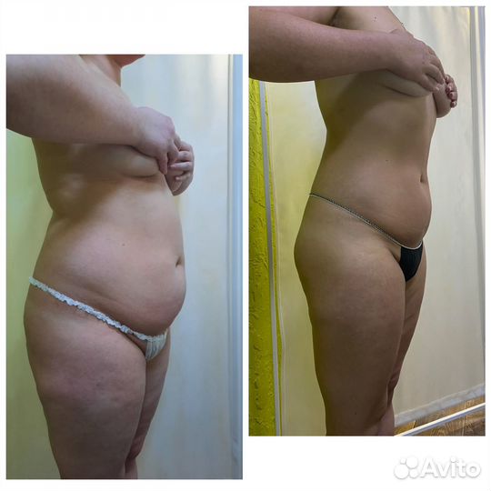 Массаж / коррекция тела и лица