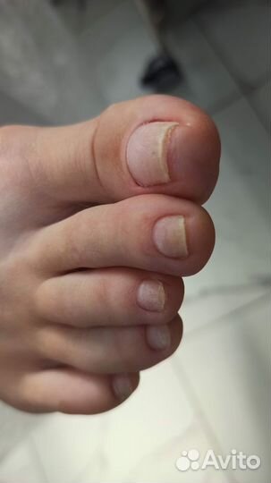 Подолог Педикюр