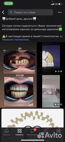 Зубной техник съемное протезирование