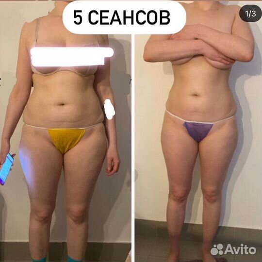 Студия коррекции фигуры и массажа у метро