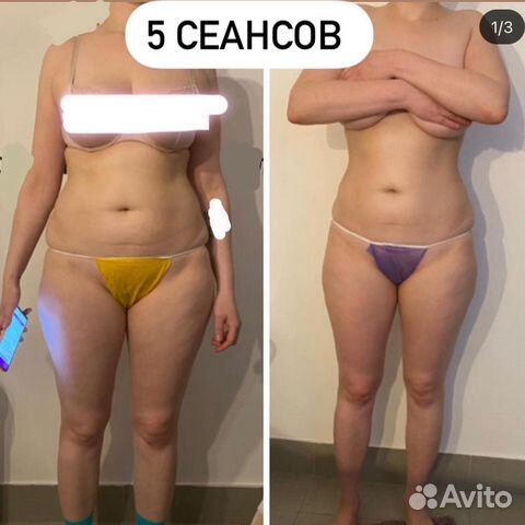 Студия коррекции фигуры и массажа у метро