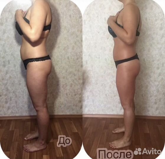 Массаж на результат, не поглаживаю. Депиляция