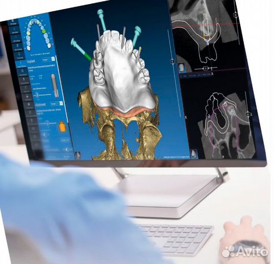 Realguide 5.3 и все версии