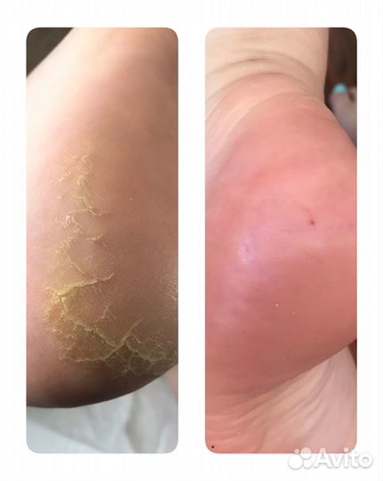 Маникюр педикюр