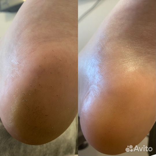 Модели на педикюр