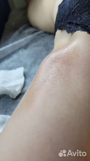 Шугаринг: бёдра