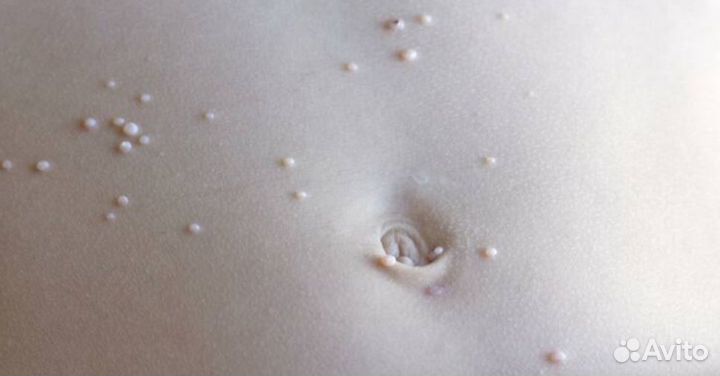 Подростковая косметология