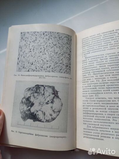 Книга СССР забрюшные опухоли медицина 1976г