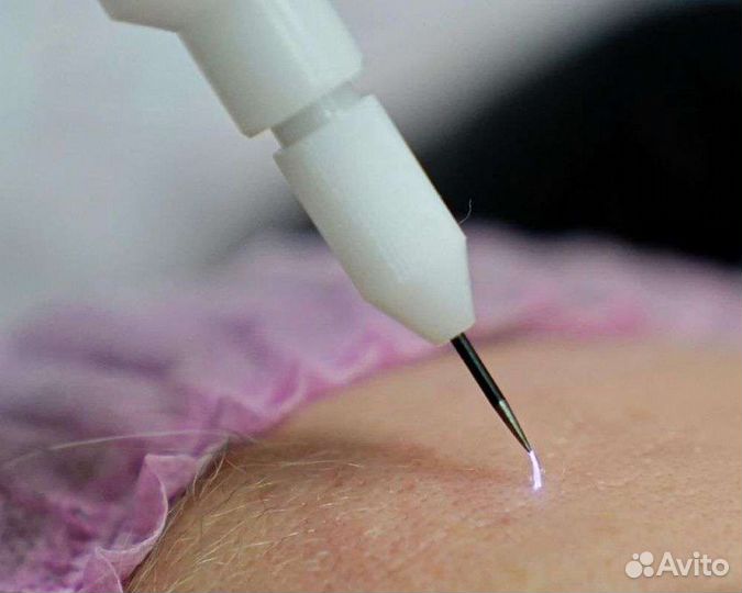 Холодная плазма