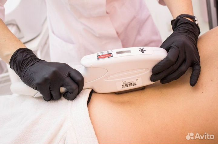 Франшиза лазерной эпиляции с клиентами