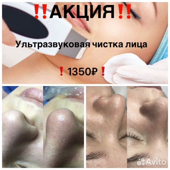 Массаж лица/микротоки/чистка лица