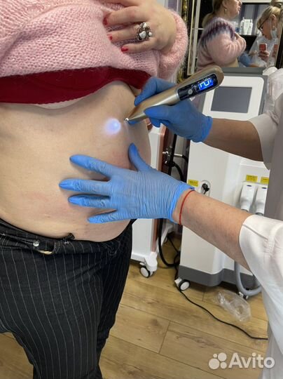 Электрокаогуляция новообразований на лице и теле