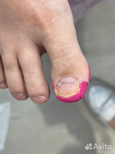 Услуги подолога