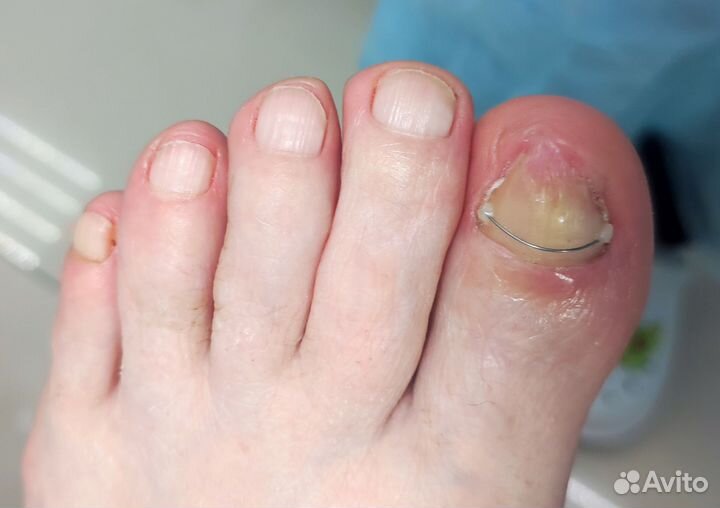 Услуги подолога