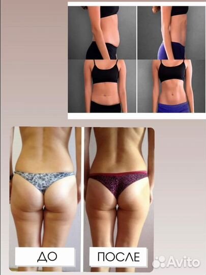 Аппаратное похудение EmsCulpt