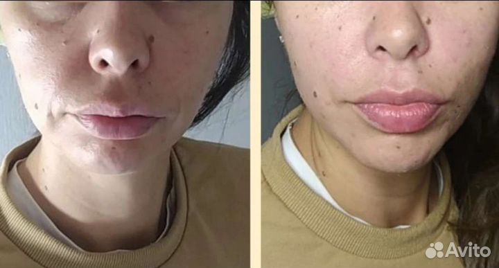 Услуги профессионального косметолога