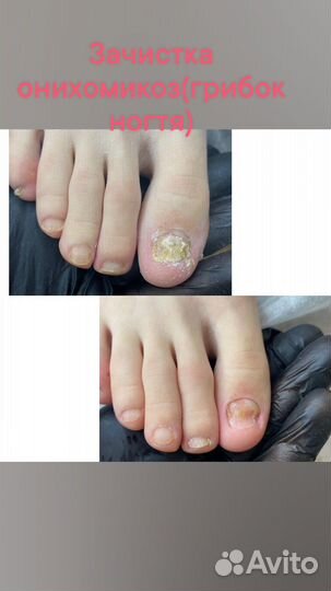 Практикующий подолог /Маникюр/Педикюр