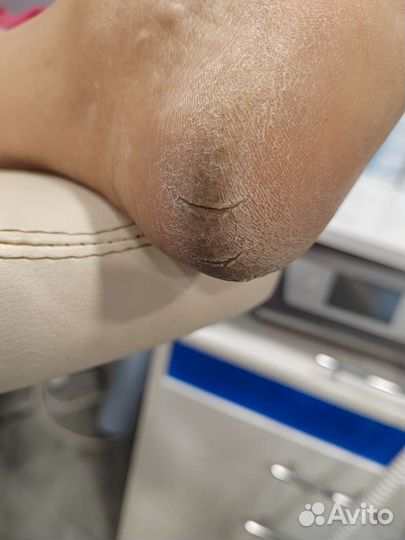 Подолог. Медицинский педикюр