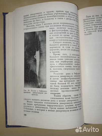 Дивертикулы пищевода. Петровский. 1968
