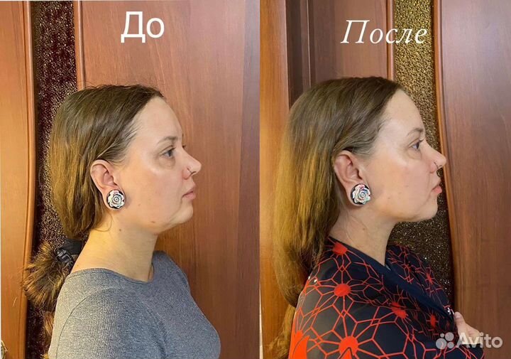 Массаж лица