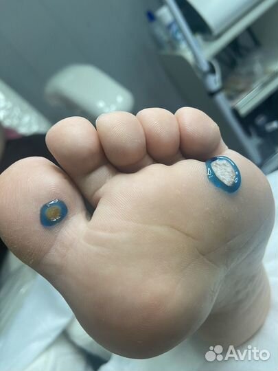 Подолог, подологический педикюр