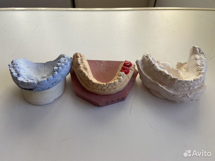 Гипсовые слепки челюсти