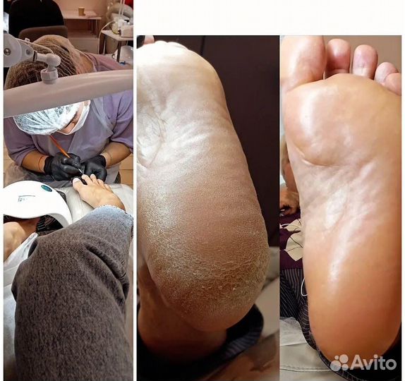 Маникюр на дому