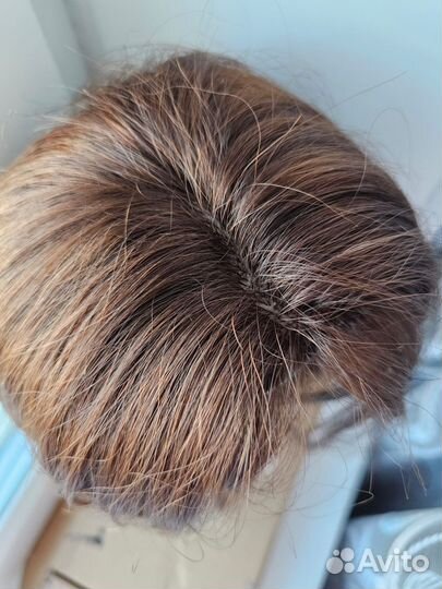 Система замещения волос