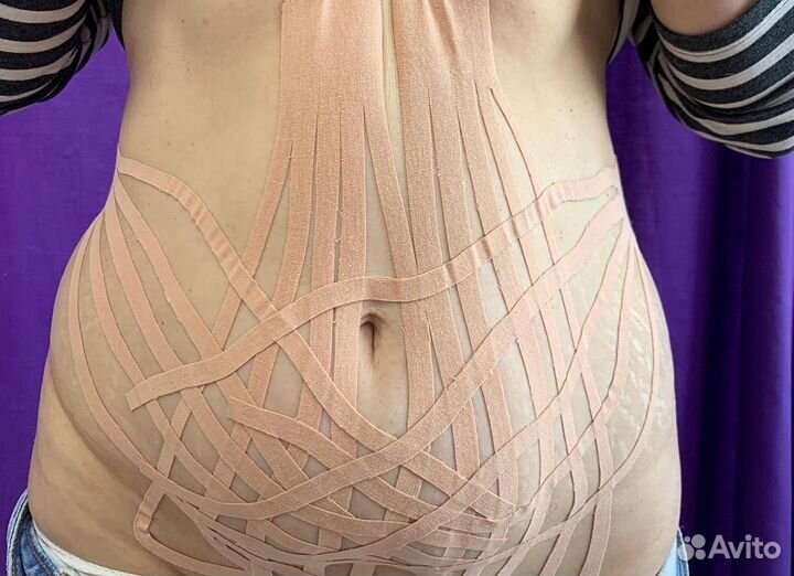 Тейпирование