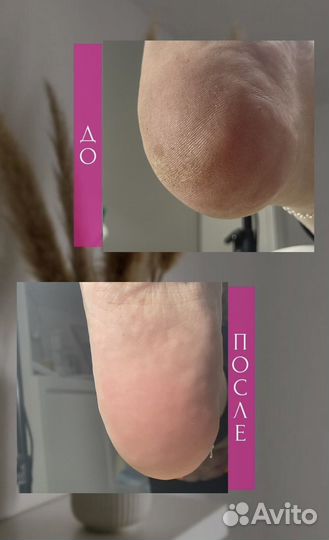 Модель на педикюр