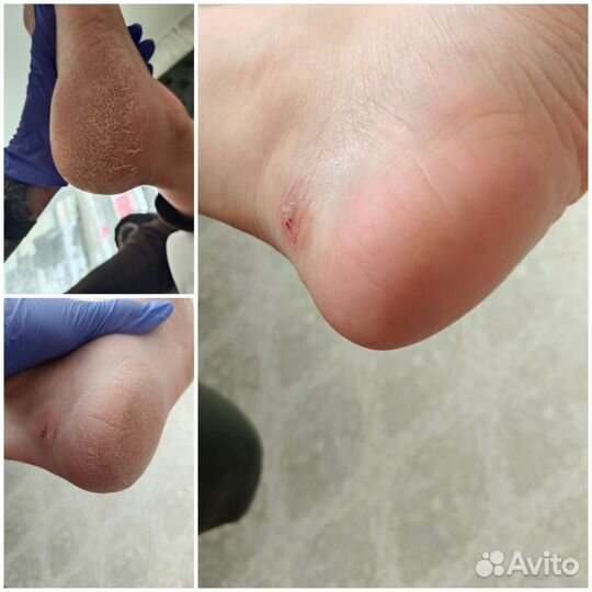 Маникюр/педикюр 10 квартал