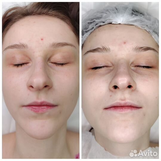 Косметолог эстетист