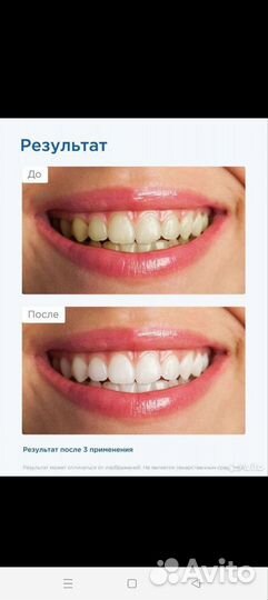 Отбеливающие полоски для зубов