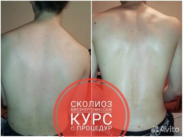 Массаж(биоэнергомассаж)