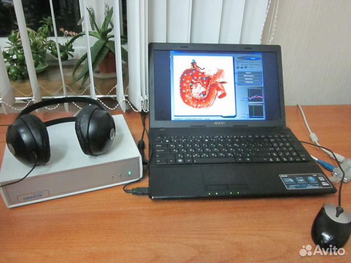 Аппарат Оберон - 17. Нутрисофт. На базе windows XP