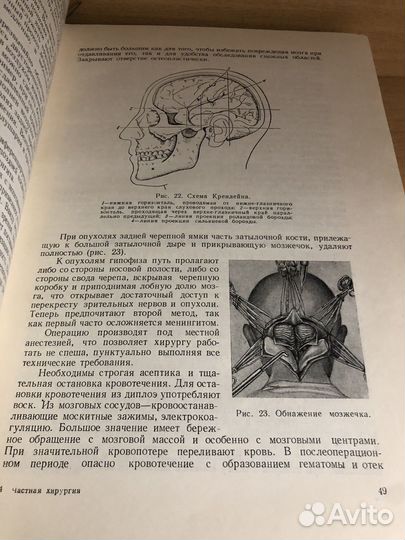 Бржозовский А.Г. Частная хирургия. 1954