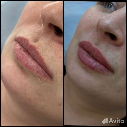 Врач косметолог - дерматолог. Стаж 15 лет